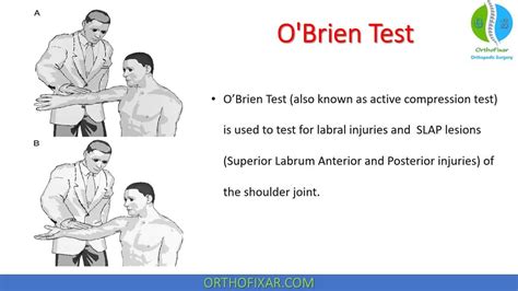 shoulder labrum tear special test|obriens test positive.